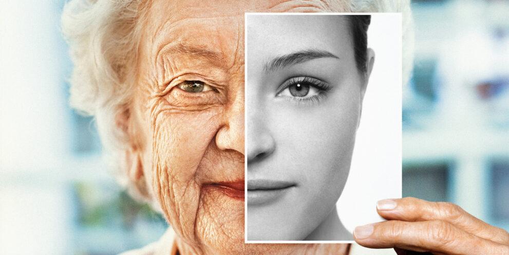 aging effects